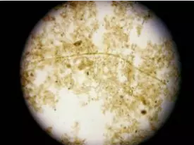 (显微镜下潮湿衣物提取的局部细菌特写).png